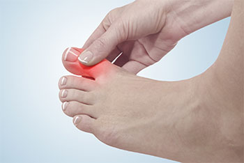 big toe arthritis treatment in the Encino, CA 91316 and Los Angeles, CA 90049 areas