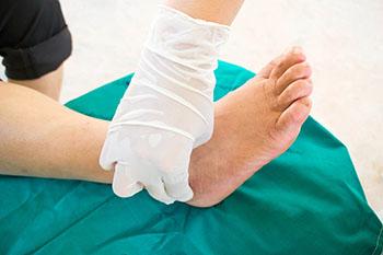 tarsal tunnel syndrome treatment in the Encino, CA 91316 and Los Angeles, CA 90049 areas